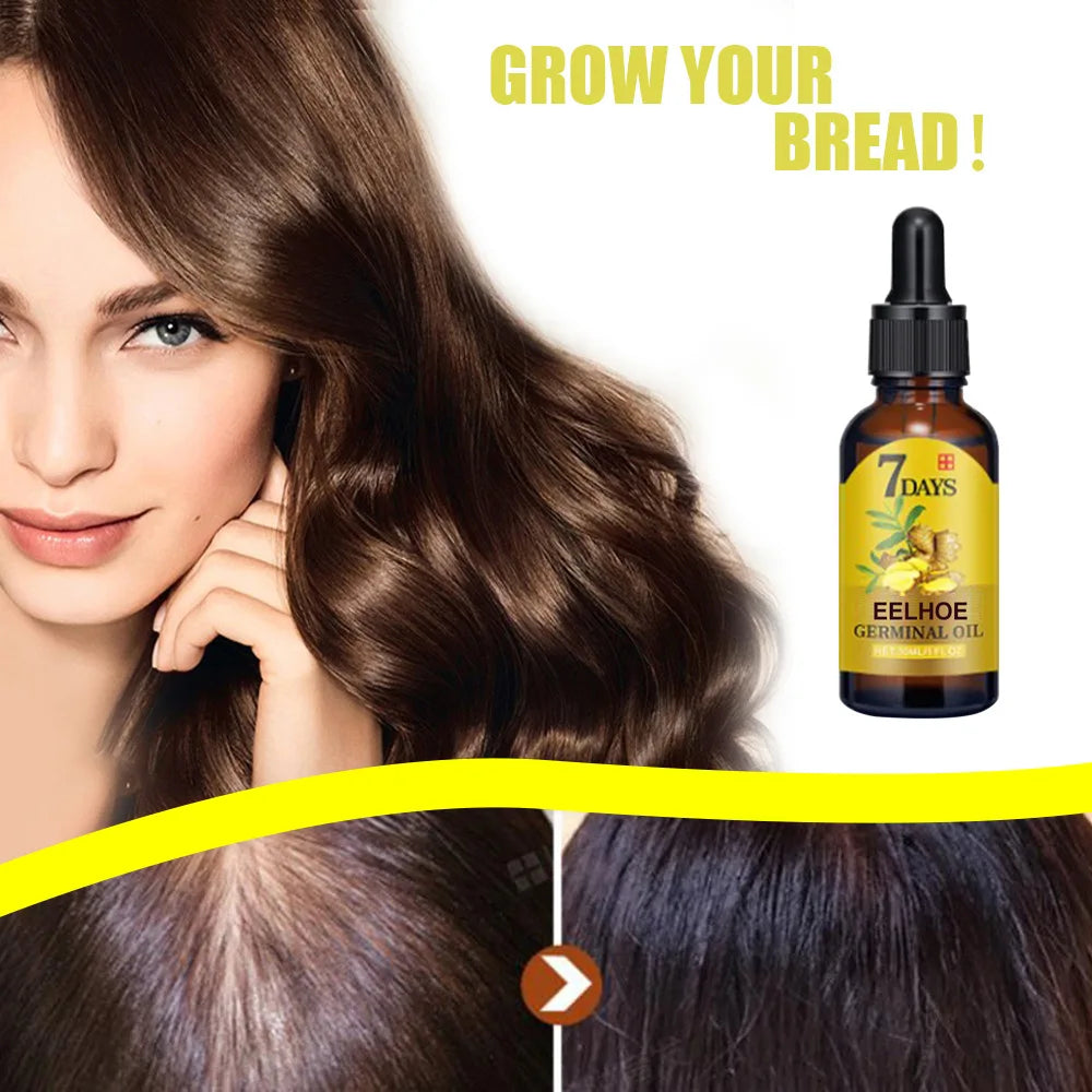 EELHOE Ginger Hair Growth Oil Natural Essentail Anti-Hair Loss